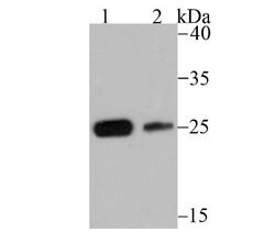 Casein Kinase 2 beta Rabbit anti-Human, Mouse, Rat, Clone: JU37-62, Novus Biologicals 100 &mu;L | Buy Online | Novus Biologicals | Fisher Scientific